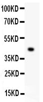 Anti-Mesothelin/MSLN Antibody Picoband®