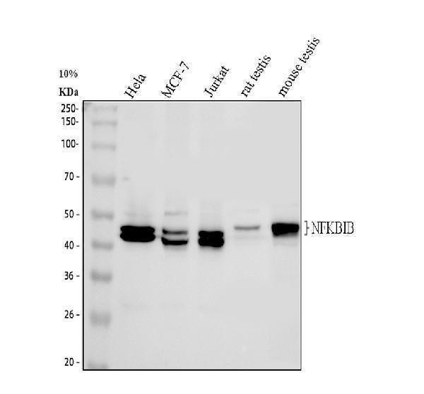 Anti-IKB beta/NFKBIB Antibody Picoband®