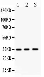 Anti-NKX2 Picoband antibody, PB9293, Western blotting
All lanes: Anti NKX2 (PB9293) at 0.5ug/ml
Lane 1: Mouse Spleen Tissue Lysate at 50ug
Lane 2: Mouse Cardiac Muscle Tissue Lysate at 50ug
Lane 3: HELA Whole Cell Lysate at 40ug
Predicted bind size: 35KD
Observed bind size: 35KD