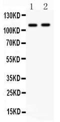 Anti-CARD4/NOD1 Antibody Picoband®