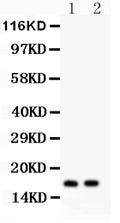 Anti-ANP Picoband antibody, PB9295, Western blotting
All lanes: Anti ANP (PB9295) at 0.5ug/ml
Lane 1: Rat Cardiac Muscle Tissue Lysate at 50ug
Lane 2: Mouse Cardiac Muscle Tissue Lysate at 50ug
Predicted bind size: 17KD
Observed bind size: 17KD