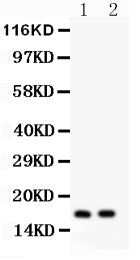 Anti-ANP Picoband antibody, PB9295, Western blotting
All lanes: Anti ANP (PB9295) at 0.5ug/ml
Lane 1: Rat Cardiac Muscle Tissue Lysate at 50ug
Lane 2: Mouse Cardiac Muscle Tissue Lysate at 50ug
Predicted bind size: 17KD
Observed bind size: 17KD