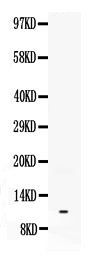Anti-Neuropeptide Y/NPY Antibody Picoband®