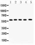 Anti-NR5A2 Picoband antibody, PB9298, Western blotting
All lanes: Anti NR5A2 (PB9298) at 0.5ug/ml
Lane 1: PANC Whole Cell Lysate at 40ug
Lane 2: HEPG2 Whole Cell Lysate at 40ug
Lane 3: A549 Whole Cell Lysate at 40ug
Lane 4: SMMC Whole Cell Lysate at 40ug
Lane 5: HELA Whole Cell Lysate at 40ug
Predicted bind size: 61KD
Observed bind size: 61KD