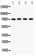 Anti-NRG1 Picoband antibody, PB9299, Western blotting
All lanes: Anti NRG1 (PB9299) at 0.5ug/ml
Lane 1: MCF-7 Whole Cell Lysate at 40ug
Lane 2: SKOV Whole Cell Lysate at 40ug
Lane 3: 22RV1 Whole Cell Lysate at 40ug
Lane 4: COLO320 Whole Cell Lysate at 40ug
Predicted bind size: 70KD
Observed bind size: 70KD