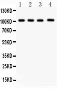 Anti-Neuropillin-1 Picoband antibody, PB9300, Western blotting
All lanes: Anti Neuropillin-1 (PB9300) at 0.5ug/ml
Lane 1: U87 Whole Cell Lysate at 40ug
Lane 2: A549 Whole Cell Lysate at 40ug
Lane 3: Human Placenta Tissue Lysate at 50ug
Lane 4: Rat Cardiac Muscle Tissue Lysate at 50ug
Predicted bind size: 103KD
Observed bind size: 103KD