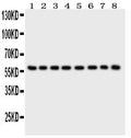 Anti-P2X2 Picoband antibody, PB9303, Western blotting
All lanes: Anti P2X2 (PB9303) at 0.5ug/ml
Lane 1: Rat Brain Tissue Lysate at 50ug
Lane 2: Mouse Brain Tissue Lysate at 50ug
Lane 3: Human Placenta Tissue Lysate at 50ug
Lane 4: HELA Whole Cell Lysate at 40ug
Lane 5: SHG Whole Cell Lysate at 40ug
Lane 6: NEURO Whole Cell Lysate at 40ug
Lane 7: 22RV1 Whole Cell Lysate at 40ug
Lane 8: U87 Whole Cell Lysate at 40ug
Predicted bind size: 52KD
Observed bind size: 60KD