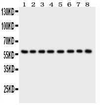 Anti-P2X2 Picoband antibody, PB9303, Western blotting
All lanes: Anti P2X2 (PB9303) at 0.5ug/ml
Lane 1: Rat Brain Tissue Lysate at 50ug
Lane 2: Mouse Brain Tissue Lysate at 50ug
Lane 3: Human Placenta Tissue Lysate at 50ug
Lane 4: HELA Whole Cell Lysate at 40ug
Lane 5: SHG Whole Cell Lysate at 40ug
Lane 6: NEURO Whole Cell Lysate at 40ug
Lane 7: 22RV1 Whole Cell Lysate at 40ug
Lane 8: U87 Whole Cell Lysate at 40ug
Predicted bind size: 52KD
Observed bind size: 60KD