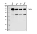 Anti-PAPP A/PAPPA Antibody Picoband®