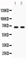 Anti-Parkin Picoband antibody, PB9307, Western blotting
All lanes: Anti Parkin (PB9307) at 0.5ug/ml
Lane 1: U87 Whole Cell Lysate at 40ug
Lane 2: Mouse Brain Tissue Lysate at 50ug
Predicted bind size: 66KD
Observed bind size: 66KD