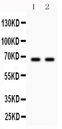 Anti-Parkin Picoband antibody, PB9307, Western blotting
All lanes: Anti Parkin (PB9307) at 0.5ug/ml
Lane 1: U87 Whole Cell Lysate at 40ug
Lane 2: Mouse Brain Tissue Lysate at 50ug
Predicted bind size: 66KD
Observed bind size: 66KD