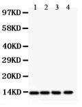 Anti-PDGF beta Picoband antibody, PB9311, Western blotting
All lanes: Anti PDGF beta (PB9311) at 0.5ug/ml
Lane 1: Rat Cardiac Muscle Tissue Lysate at 50ug
Lane 2: Rat Brain Tissue Lysate at 50ug
Lane 3: Mouse Cardiac Muscle Tissue Lysate at 50ug
Lane 4: HELA Whole Cell Lysate at 40ug
Predicted bind size: 27KD
Observed bind size: 13KD