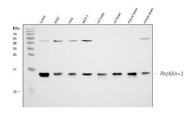 Anti-Profilin 1/PFN1 Antibody Picoband®