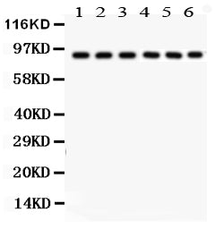 Anti-Oct-1 Picoband antibody, PB9317, Western blotting
All lanes: Anti Oct-1 (PB9317) at 0.5ug/ml
Lane 1: Rat Liver Tissue Lysate at 50ug
Lane 2: Human Placenta Tissue Lysate at 50ug
Lane 3: JURKAT Whole Cell Lysate at 40ug
Lane 4: HELA Whole Cell Lysate at 40ug
Lane 5: A549 Whole Cell Lysate at 40ug
Lane 6: SMMC Whole Cell Lysate at 40ug
Predicted bind size: 90KD
Observed bind size: 90KD