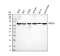 Anti-PKC beta 1/PRKCB Antibody Picoband®