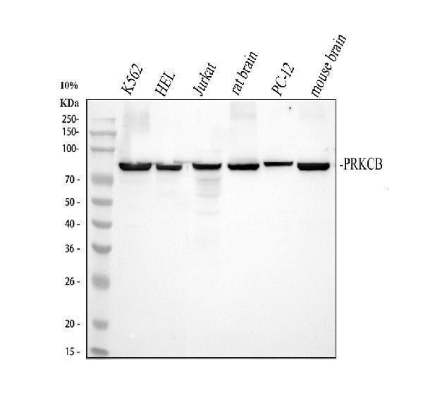 Anti-PKC beta 1/PRKCB Antibody Picoband®