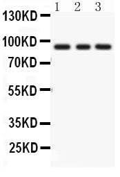 Anti-PKC epsilon/PRKCE Antibody Picoband®