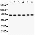 Anti-PKC iota Picoband antibody, PB9321, Western blotting
All lanes: Anti PKC iota (PB9321) at 0.5ug/ml
Lane 1: SHG Whole Cell Lysate at 40ug
Lane 2: A549 Whole Cell Lysate at 40ug
Lane 3: U87 Whole Cell Lysate at 40ug
Lane 4: 293T Whole Cell Lysate at 40ug
Lane 5: HELA Whole Cell Lysate at 40ug
Lane 6: JURKAT Whole Cell Lysate at 40ug
Predicted bind size: 68KD
Observed bind size: 68KD