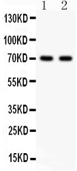 Anti-SHBG Picoband antibody, PB9326, Western blotting
 All lanes: Anti SHBG (PB9326) at 0.5ug/ml
Lane 1: HELA Whole Cell Lysate at 40ug
Lane 2: COLO320 Whole Cell Lysate at 40ug
Predicted bind size: 44KD
Observed bind size: 70KD