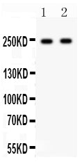 Anti-CaV1.3/CACNA1D Antibody Picoband®