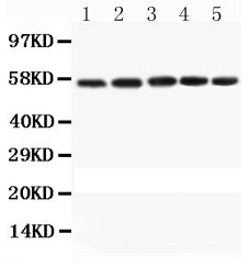 Anti-Caspase 8 Picoband antibody, PB9331, Western blotting
All lanes: Anti Caspase 8 (PB9331) at 0.5ug/ml
Lane 1: Mouse Spleen Tissue Lysate at 50ug
Lane 2: Mouse Thymus Tissue Lysate at 50ug
Lane 3: Mouse Kidney Tissue Lysate at 50ug
Lane 4: Mouse Lung Tissue Lysate at 50ug
Lane 5: HEPA  Cell Lysate at 40ug
Predicted bind size: 55KD
Observed bind size: 55KD