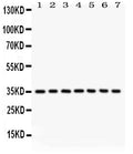 Anti-Caspase-9 Picoband antibody, PB9332, Western blotting
All lanes: Anti Caspase-9 (PB9332) at 0.5ug/ml
Lane 1: A549 Whole Cell Lysate at 40ug
Lane 2: SMMC Whole Cell Lysate at 40ug
Lane 3: 293T Whole Cell Lysate at 40ug
Lane 4: JURKAT Whole Cell Lysate at 40ug
Lane 5: RAJI Whole Cell Lysate at 40ug
Lane 6: CEM Whole Cell Lysate at 40ug
Lane 7: HUT Whole Cell Lysate at 40ug
Predicted bind size: 35KD
Observed bind size: 35KD
