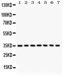 Anti-Caspase-9 Picoband antibody, PB9332, Western blotting
All lanes: Anti Caspase-9 (PB9332) at 0.5ug/ml
Lane 1: A549 Whole Cell Lysate at 40ug
Lane 2: SMMC Whole Cell Lysate at 40ug
Lane 3: 293T Whole Cell Lysate at 40ug
Lane 4: JURKAT Whole Cell Lysate at 40ug
Lane 5: RAJI Whole Cell Lysate at 40ug
Lane 6: CEM Whole Cell Lysate at 40ug
Lane 7: HUT Whole Cell Lysate at 40ug
Predicted bind size: 35KD
Observed bind size: 35KD