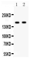 Anti-NMDAR2A Picoband antibody, PB9335, Western blotting
All lanes: Anti NMDAR2A (PB9335) at 0.5ug/ml
Lane 1: Rat Brain Tissue Lysate at 50ug
Lane 2: Mouse Brain Tissue Lysate at 50ug
Predicted bind size: 165KD
Observed bind size: 165KD
