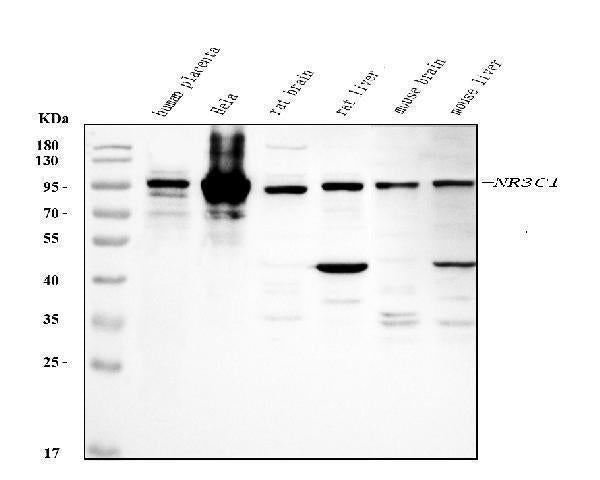 Anti-Glucocorticoid Receptor/NR3C1 Antibody Picoband®