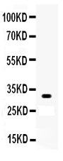 Anti-Otx2 Picoband antibody, PB9344, Western blotting
All lanes: Anti Otx2 (PB9344) at 0.5ug/ml
WB: COLO320 Whole Cell Lysate at 40ug
Predicted bind size: 32KD
Observed bind size: 32KD