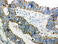 Anti-Peroxiredoxin 3/PRDX3 Antibody Picoband®