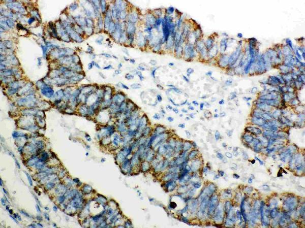 Anti-Peroxiredoxin 3/PRDX3 Antibody Picoband®