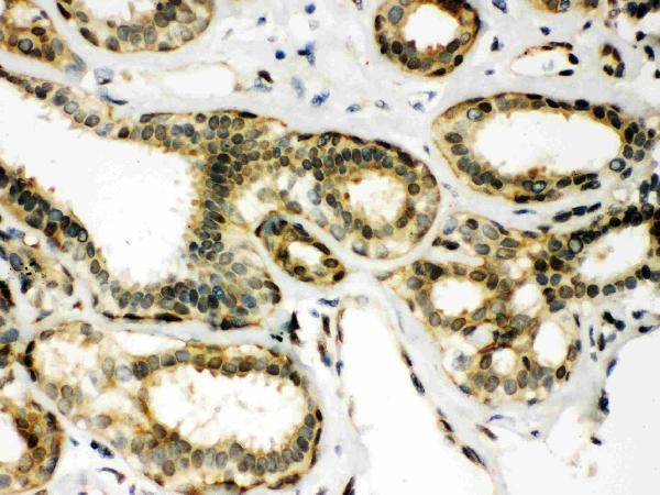 Anti-Peroxiredoxin 6/PRDX6 Antibody Picoband®