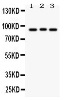 Anti-Semaphorin 3A Picoband antibody, PB9353, Western blotting
All lanes: Anti Semaphorin 3A (PB9353) at 0.5ug/ml
Lane 1: 293T Whole Cell Lysate at 40ug
Lane 2: A549 Whole Cell Lysate at 40ug
Lane 3: HELA Whole Cell Lysate at 40ug
Predicted bind size: 89KD
Observed bind size: 89KD