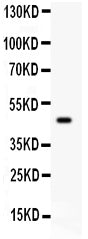 Anti-SerpinB2 Picoband antibody, PB9355, Western blotting
All lanes: Anti SerpinB2 (PB9355) at 0.5ug/ml
WB: Human Placenta Tissue Lysate at 50ug
Predicted bind size: 47KD
Observed bind size: 47KD