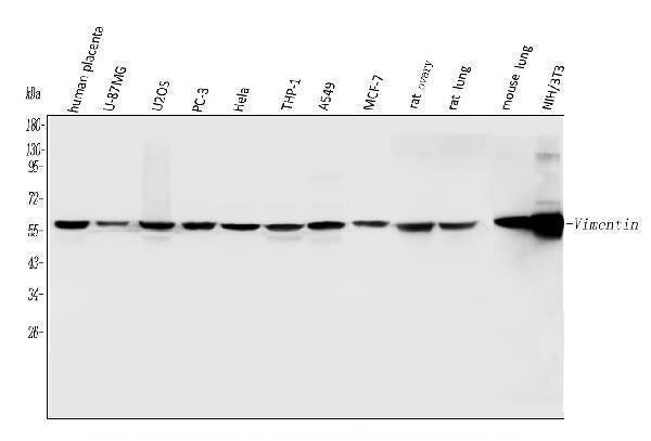 Anti-Vimentin Antibody Picoband®