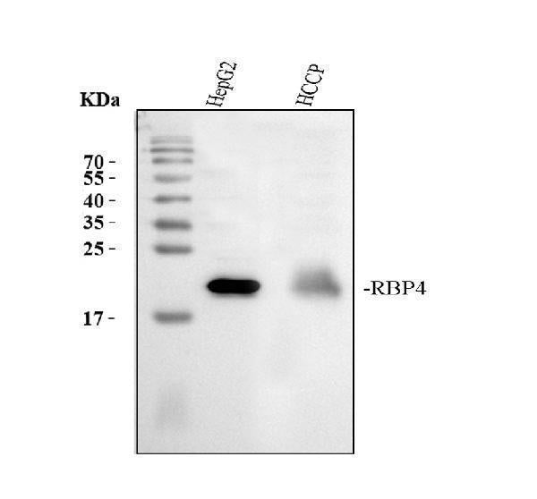 Anti-RBP4 Antibody Picoband®