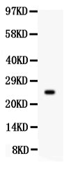 Anti-Prolactin Picoband antibody, PB361, Western blotting
All lanes: Anti Prolactin (PB9361) at 0.5ug/ml

WB: MCF-7 Whole Cell Lysate at 40ug

Predicted bind size: 25KD

Observed bind size: 25KD