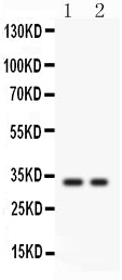 Anti-SFRP2 Picoband antibody, PB9362, Western blotting
All lanes: Anti SFRP2 (PB9362) at 0.5ug/ml
Lane 1: COLO320 Whole Cell Lysate at 40ug
Lane 2: SW620 Whole Cell Lysate at 40ug
Predicted bind size: 33KD
Observed bind size: 33KD