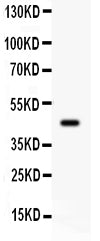 Anti-ADRB2 Picoband antibody, PB9365, Western blotting
All lanes: AntiADRB2 (PB9365) at 0.5ug/ml
WB: Rat Brain Tissue Lysate at 50ug
Predicted bind size: 47KD
Observed bind size: 47KD