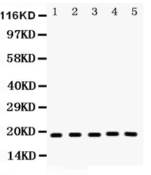 Anti-Caspase-2 Picoband antibody, PB9368, Western blotting

All lanes: Anti Caspase-2 (PB9368) at 0.5ug/ml
Lane 1: Rat Lung Tissue Lysate at 50ug
Lane 2: Mouse Liver Tissue Lysate at 50ug
Lane 3: A549 Whole Cell Lysate at 40ug
Lane 4: PANC Whole Cell Lysate at 40ug
Lane 5: 293T Whole Cell Lysate at 40ug
Predicted bind size: 18KD
Observed bind size: 18KD