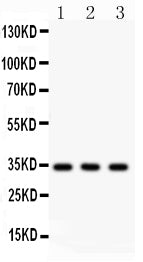 Anti-Caspase-7 Picoband antibody, PB9369, Western blotting
All lanes: Anti Caspase-7(PB9369) at 0.5ug/ml
Lane 1: A549 Whole Cell Lysate at 40ug
Lane 2: Rat Spleen Tissue Lysate at 50ug
Lane 3: Rat Lung Tissue Lysate at 50ug
Predicted bind size: 34KD
Observed bind size: 34KD