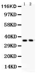 Anti-FRZB Picoband antibody, PB9372, Western blotting
All lanes: Anti FRZB (PB9372) at 0.5ug/ml
Lane 1: PANC Whole Cell Lysate at 40ug
Lane 2: U87 Whole Cell Lysate at 40ug
Predicted bind size: 36KD
Observed bind size: 36KD
