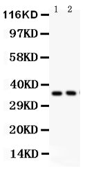 Anti-FRZB Picoband antibody, PB9372, Western blotting
All lanes: Anti FRZB (PB9372) at 0.5ug/ml
Lane 1: PANC Whole Cell Lysate at 40ug
Lane 2: U87 Whole Cell Lysate at 40ug
Predicted bind size: 36KD
Observed bind size: 36KD