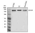 Anti-NMDAR2B/GRIN2B Antibody Picoband®