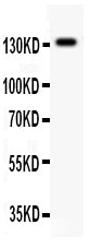 Anti-NMDAR2C Picoband antibody, PB9374, Western blotting
All lanes: Anti NMDAR2C (PB9374) at 0.5ug/ml
WB: Rat Brain Tissue Lysate at 50ug
Predicted bind size: 134KD
Observed bind size: 134KD