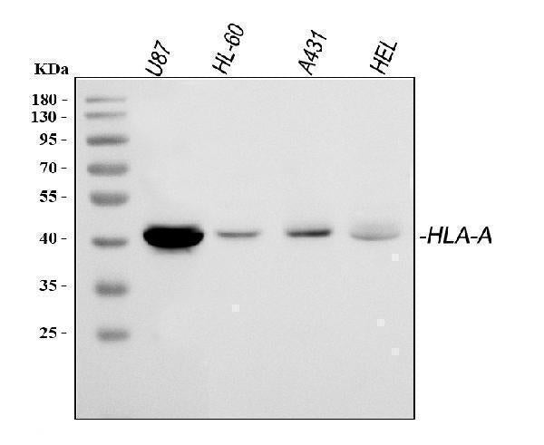 Anti-HLA A/HLA-A Antibody Picoband®