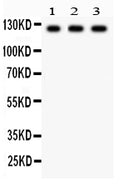 Anti-PLD1 Picoband antibody, PB9380, Western blotting
All lanes: Anti PLD1 (PB9380) at 0.5ug/ml
Lane 1: Mouse Cardiac Muscle Tissue Lysate at 50ug
Lane 2: 22RV1 Whole Cell Lysate at 40ug
Lane 3: HELA Whole Cell Lysate at 40ug
Predicted bind size: 124KD
Observed bind size: 124KD