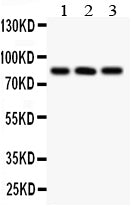 Anti-Calcineurin A Picoband antibody, PB9382, Western blotting
All lanes: Anti Calcineurin A (PB9382) at 0.5ug/ml
Lane 1: HELA Whole Cell Lysate at 40ug
Lane 2: A549 Whole Cell Lysate at 40ug
Lane 3: COLO320 Whole Cell Lysate at 40ug
Predicted bind size: 59KD
Observed bind size: 84KD