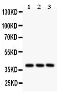 Anti-PTGER2 Picoband antibody, PB9386, Western blotting
All lanes: Anti PTGER2 (PB9386) at 0.5ug/ml

Lane 1: Human Placenta Tissue Lysate at 50ug

Lane 2: A549 Whole Cell Lysate at 40ug

Lane 3: HEPG2 Whole Cell Lysate at 40ug

Predicted bind size: 40KD

Observed bind size: 40KD